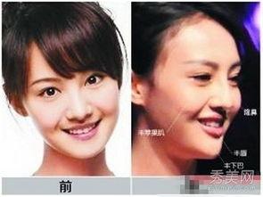 福州整形爆料事件真相视频,揭秘真相与争议  第3张 福州整形爆料事件真相视频,揭秘真相与争议  第3张